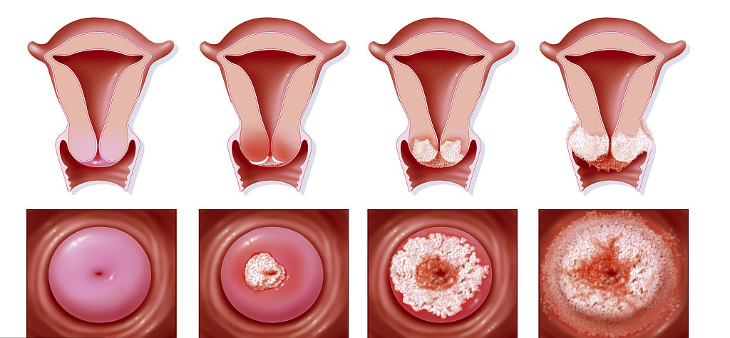 宫颈疾病会不会影响怀孕.jpg