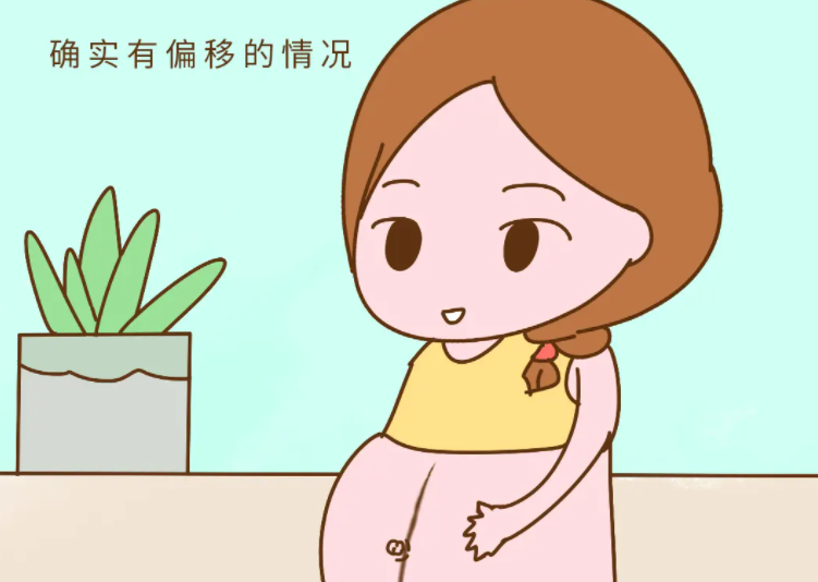 妊娠线与男女有关系吗.png