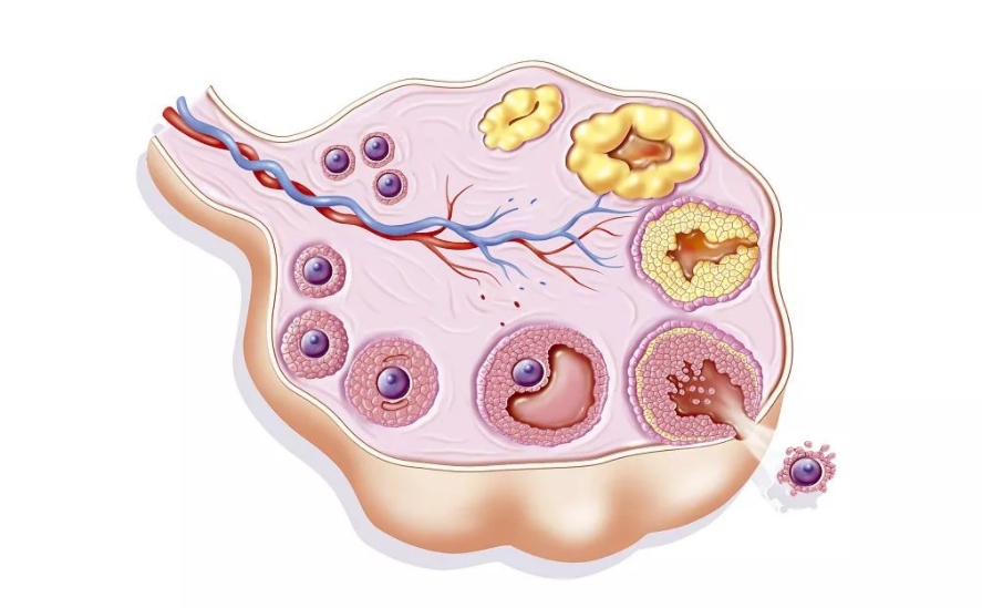 卵泡萎缩是什么原因引起的.png
